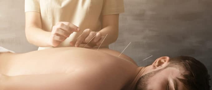 acupuncture working on male patient