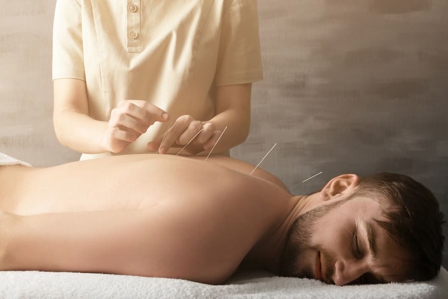 acupuncture working on male patient