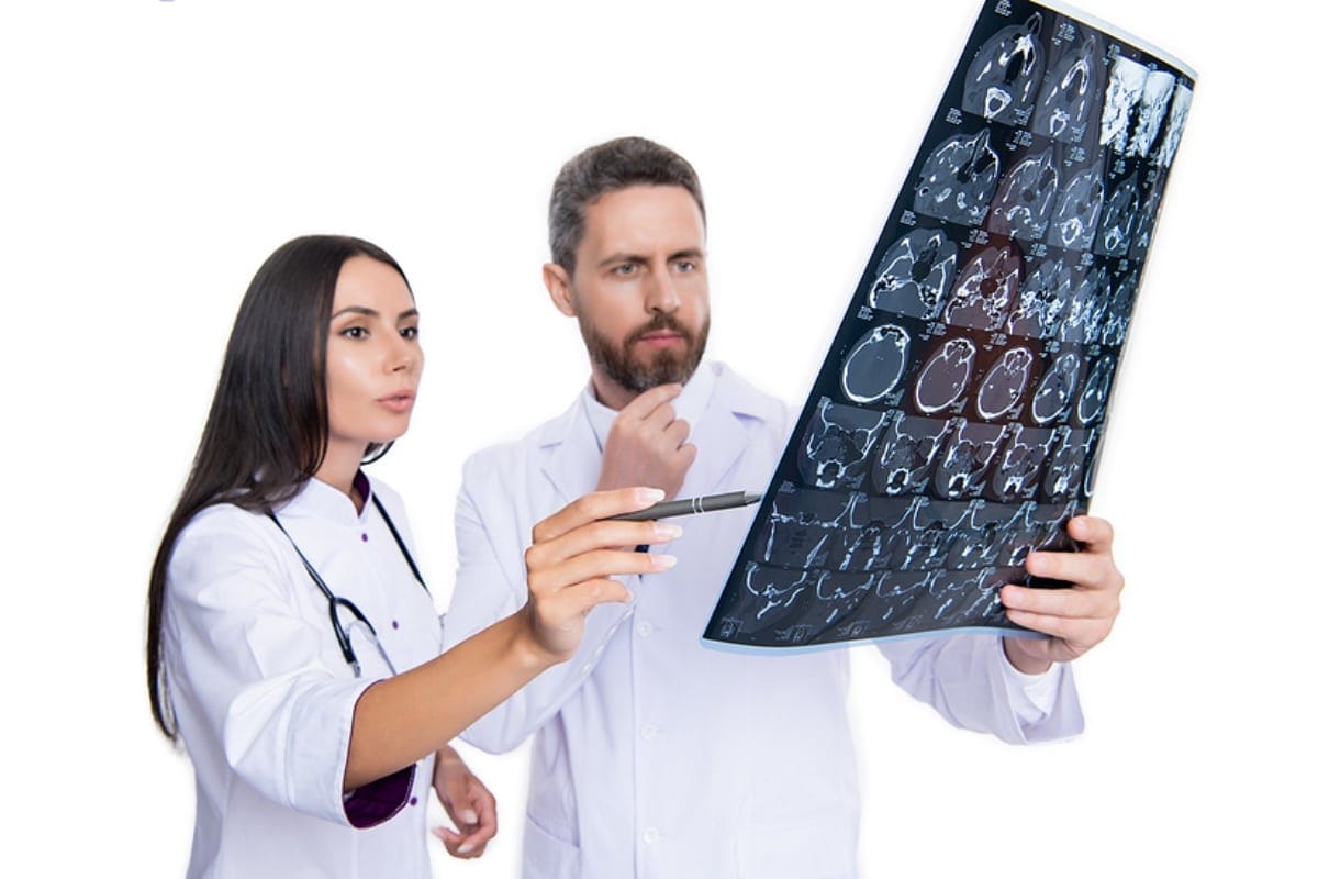 xray scan in hands of doctor neurologist.