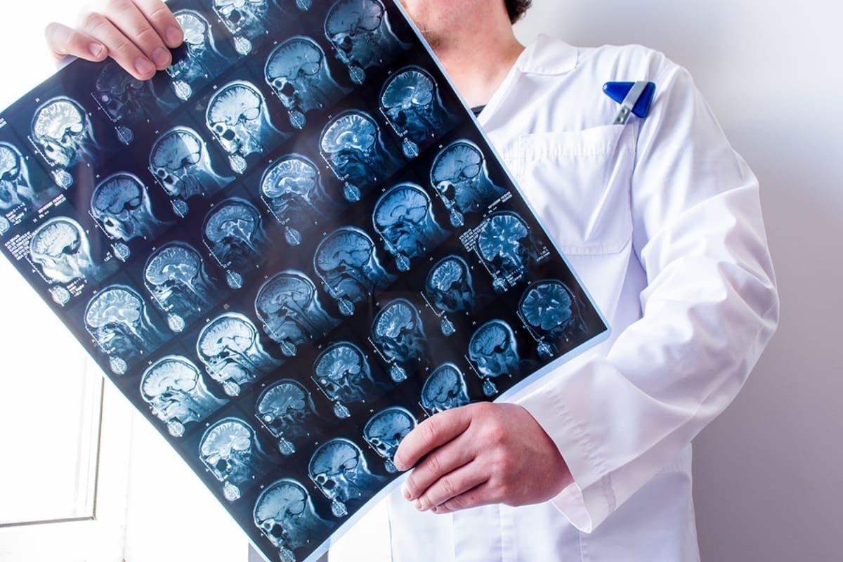 Neurologist or neurosurgeon upright holding MRI brain scanning